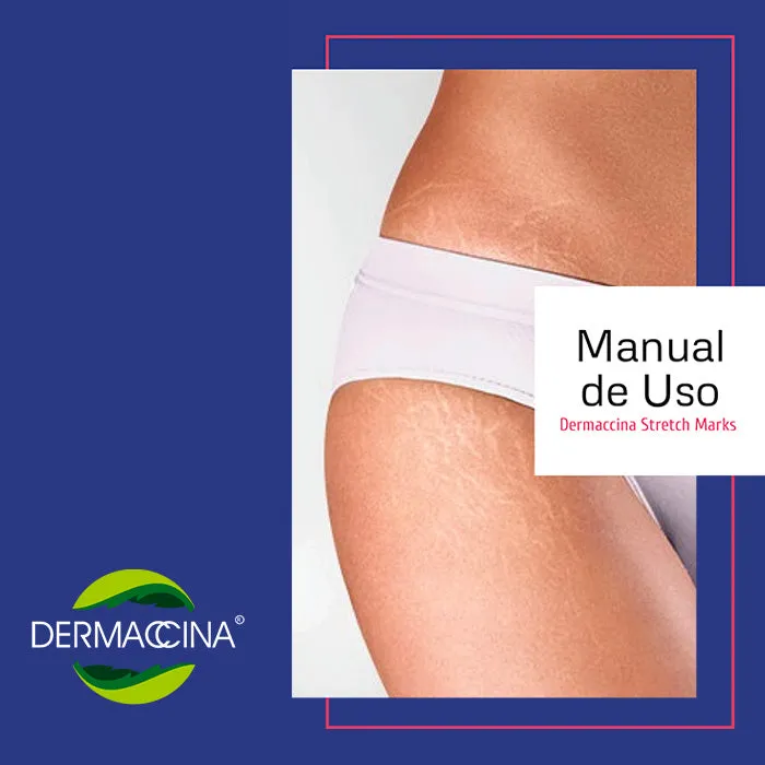 Dermaccina Estrías Tratamiento Básico